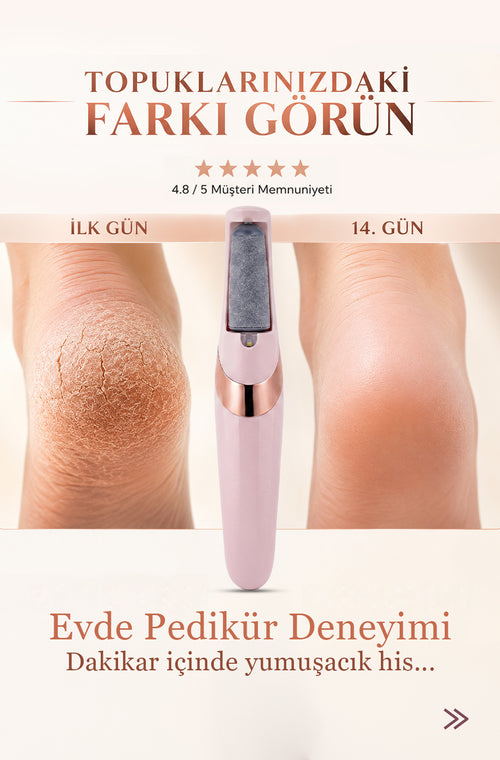 LuxeStep™ Pro - Pedikür Bakım Seti